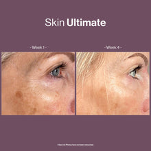 Load image into Gallery viewer, Happy Skin Ultimate