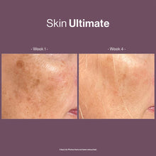 Load image into Gallery viewer, Happy Skin Ultimate