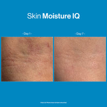 Load image into Gallery viewer, Skin Moisture IQ